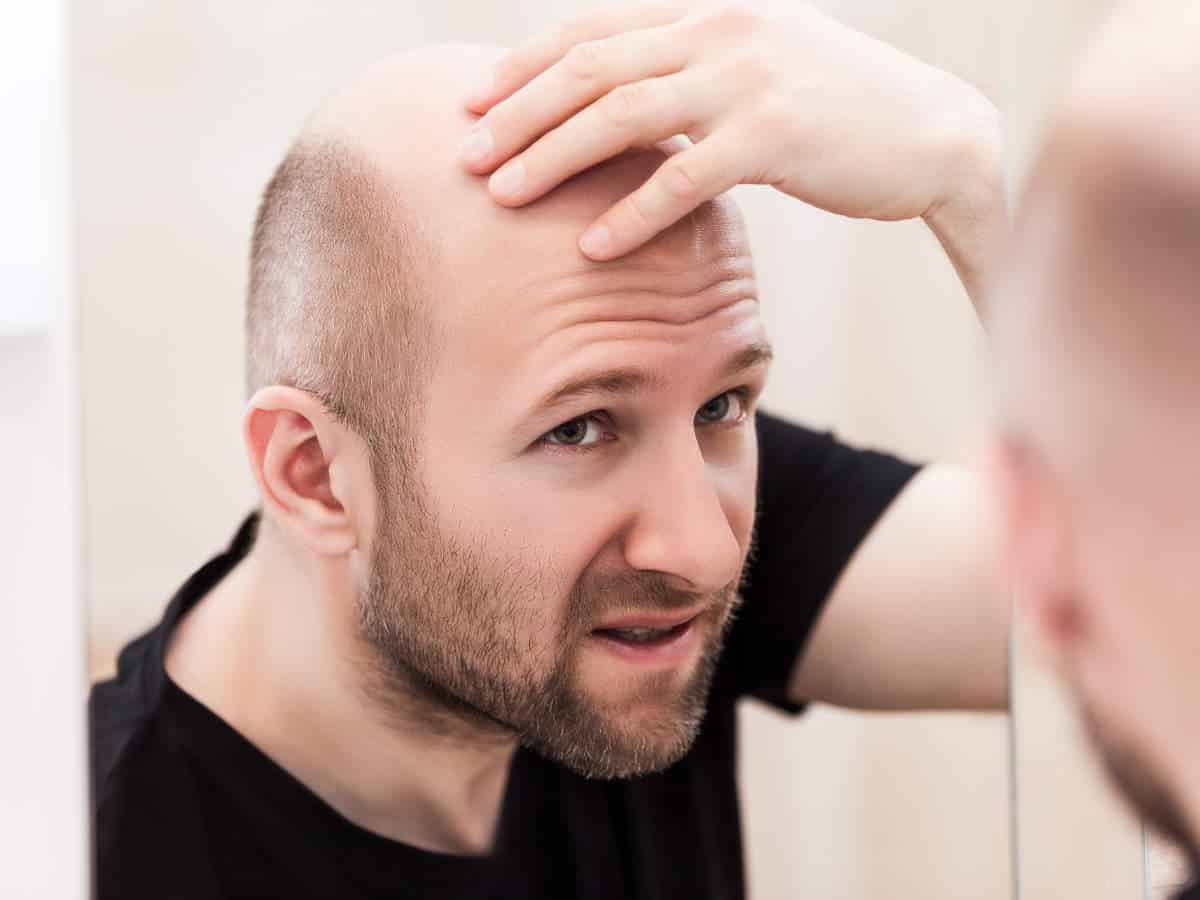 Hair Loss Treatment For Men