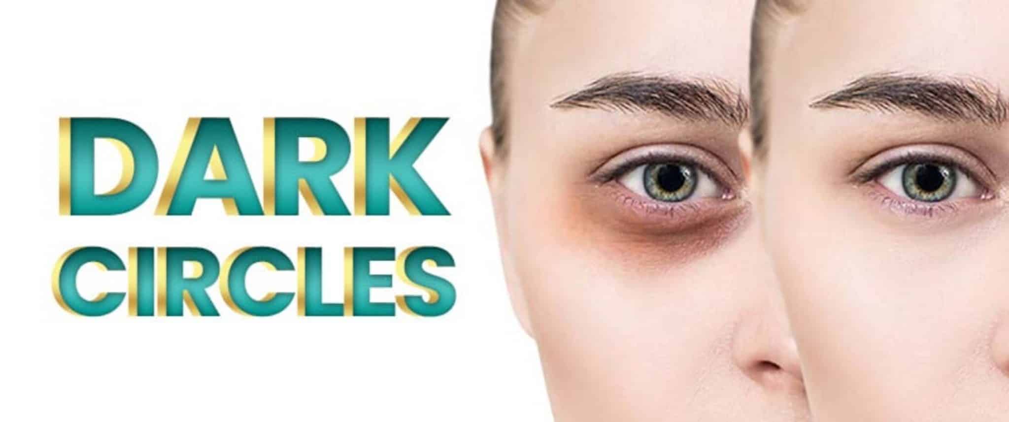 surgeon-and-dermatologist-explain-what-causes-dark-circles-under-eyes