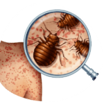 bed bug control in dubai