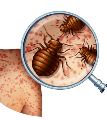 bed bug control in dubai